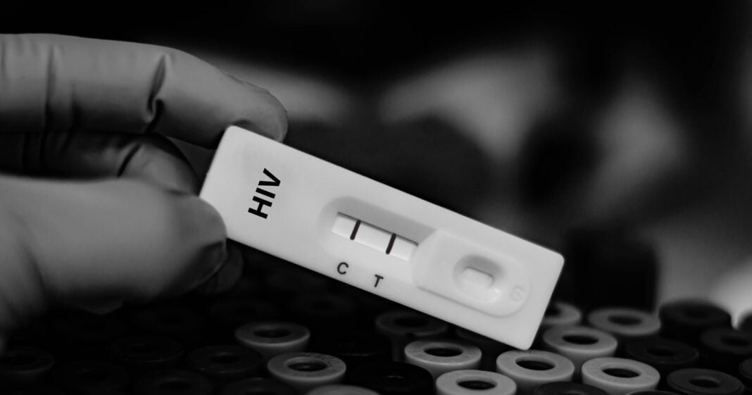 Blood sample of patient positive tested for anti-HIV by rapid diagnostic test.