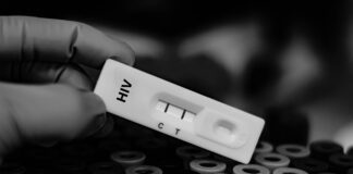 Blood sample of patient positive tested for anti-HIV by rapid diagnostic test.